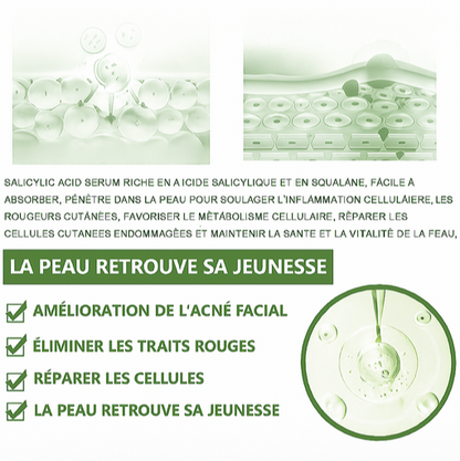 Sérum visage - Anti-Acné